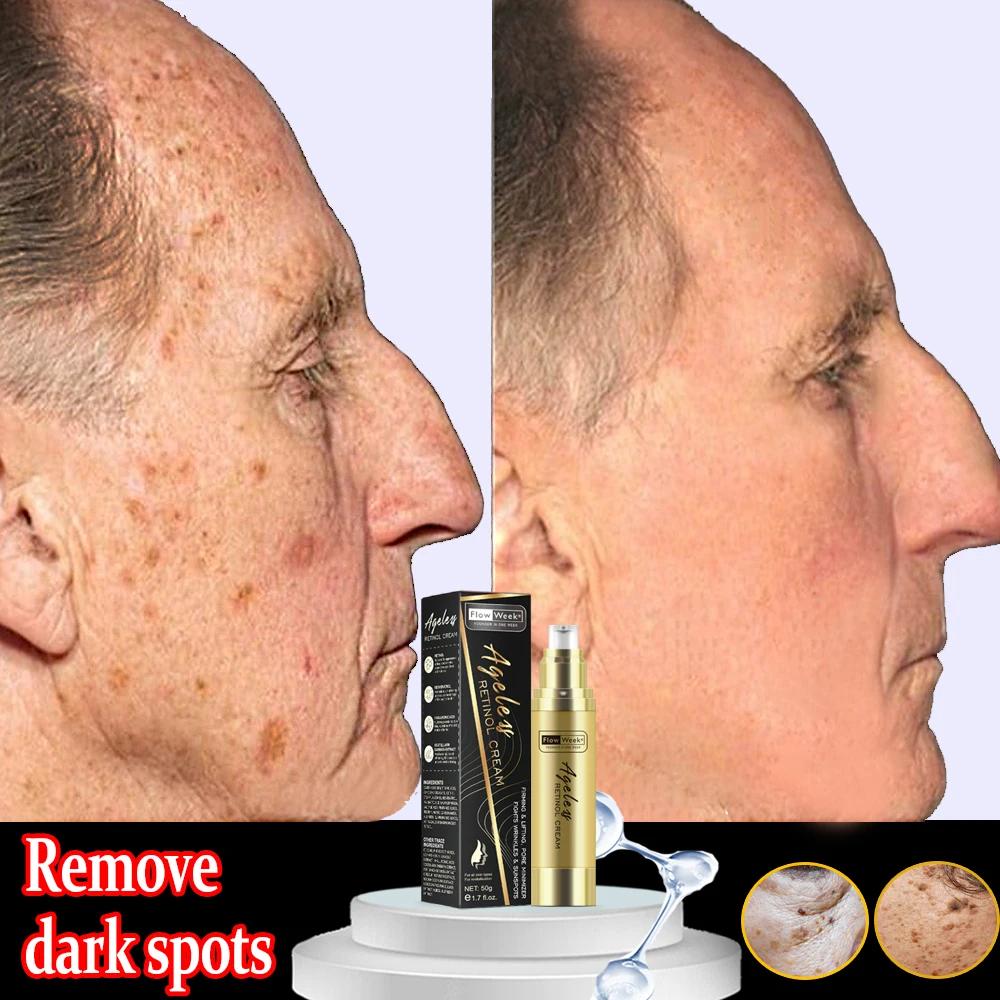 Flow-du-- Crème pour le visage raffermissante au rétinol, Essence anti-âge, Élimine les tâches brune