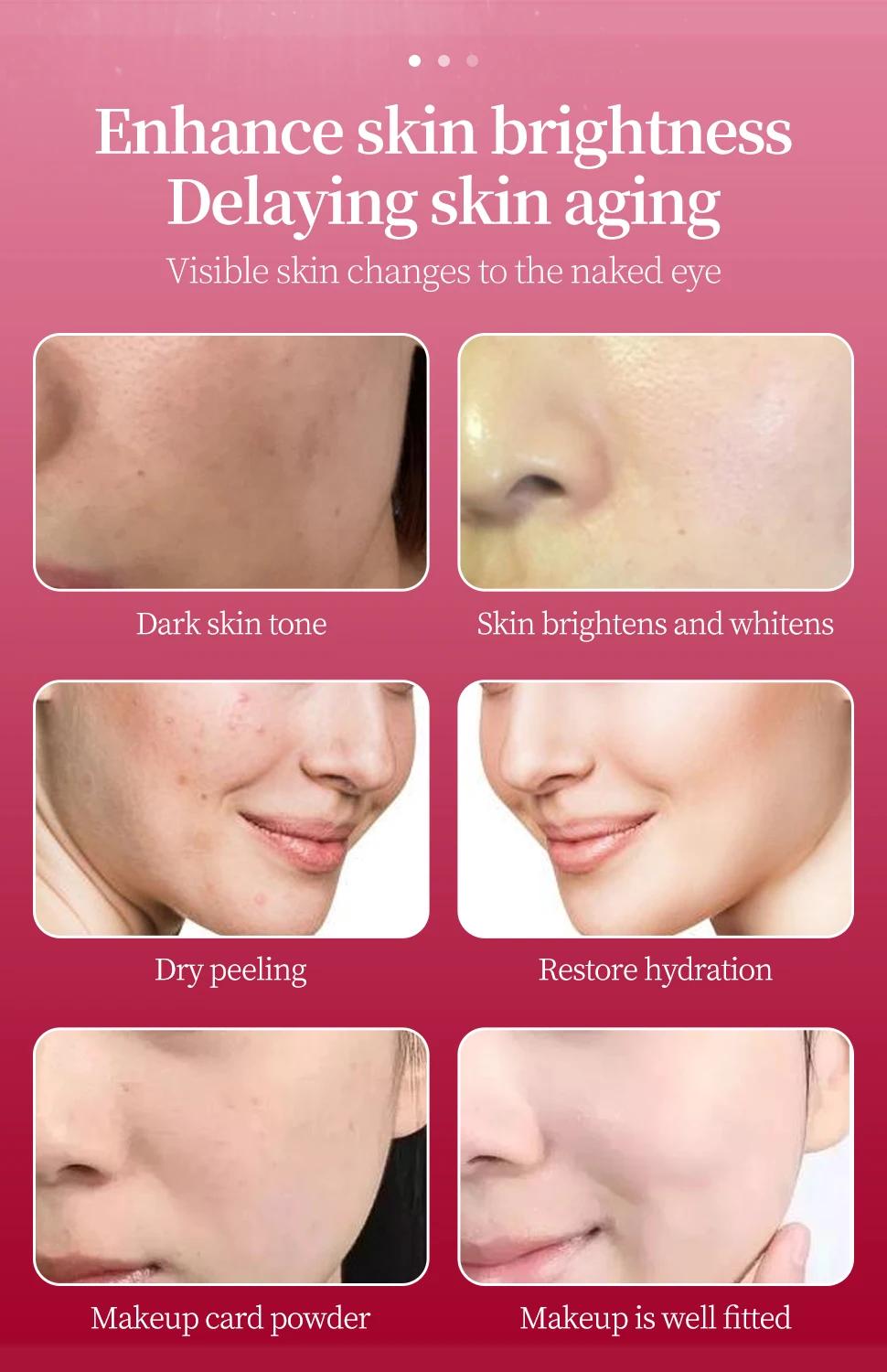 2520 Jet Peel sérum Ampoules Soins de la peau Anti-âge Acide hyaluronique Niacinamide Vitamine C E S