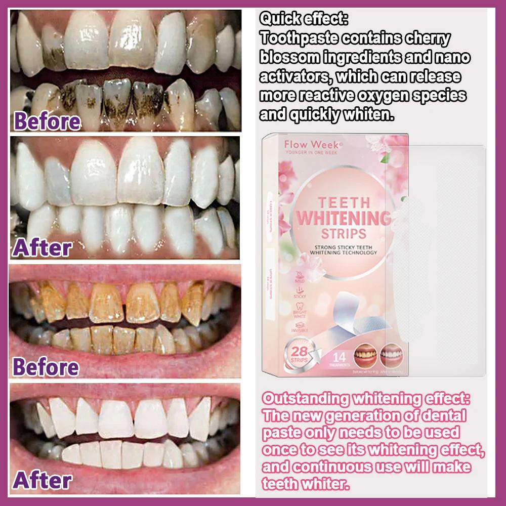 Flow-du-- Placages de protection dentaire, bandes de gel de placage dentaire, kit de soins bucco-den