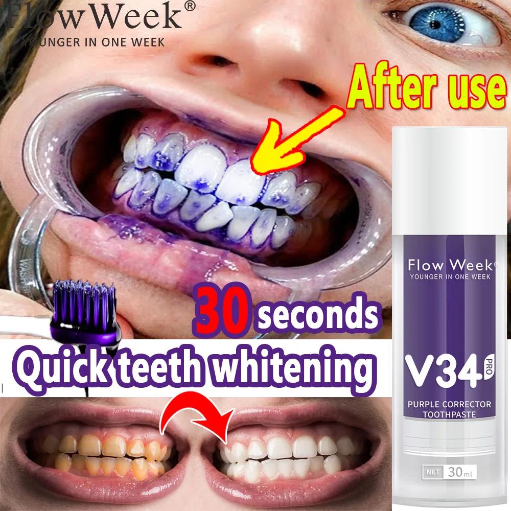 Flow-du-- Dentifrice orthodontique V34 Pro, Protection des dents, Soin de l'émail dentaire, Décontam