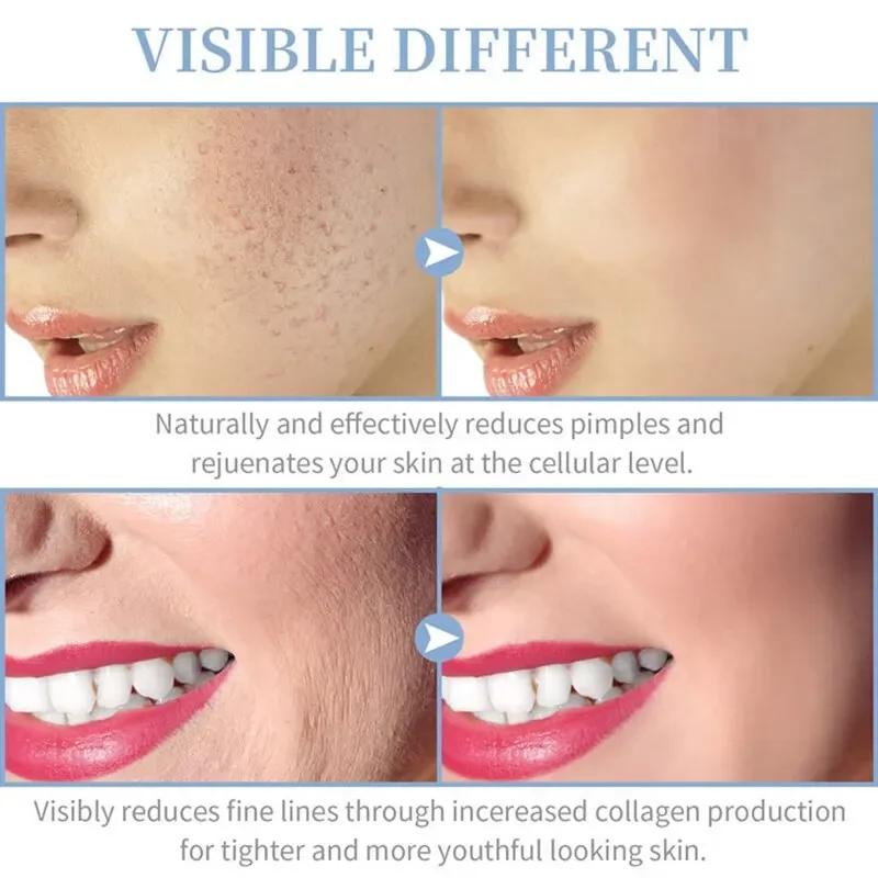 4 en 1 électrique portatif pour le visage outils de beauté de la peau Portable haute fréquence bague