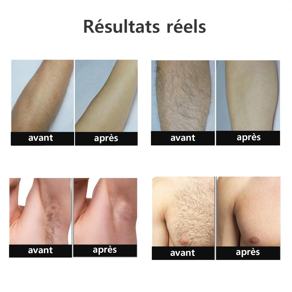 999999 Flashes épilateur Laser pour femmes hommes corps Bikini jambes bras aisselles épilation indolore IPL
