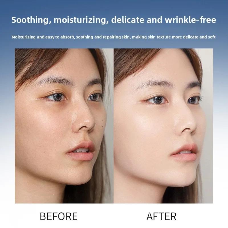 Sérum à l'acide hyaluronique, Anti-âge, hydratant, rétrécit les Pores, Essence blanchissante hydratante pour Instruments à micro-aiguilles, soins pour la peau