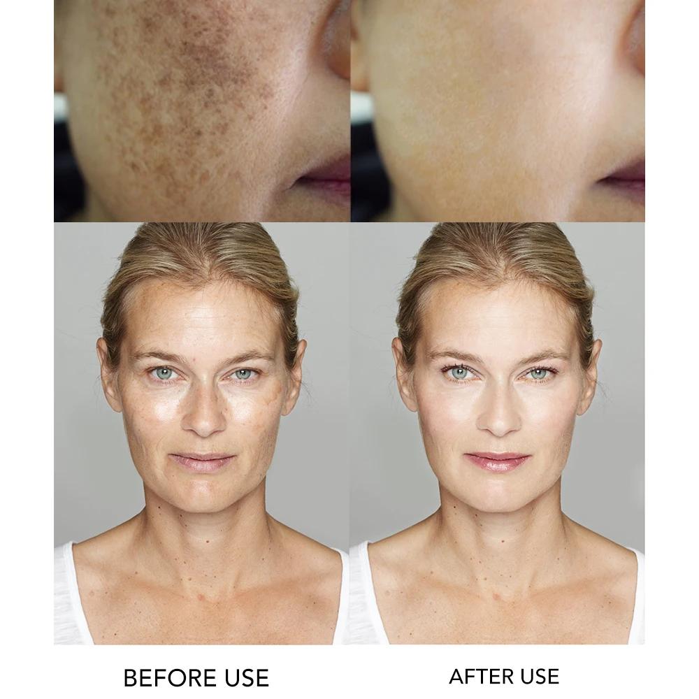 AILKE sérum visage blanchissant, avec acide hyaluronique hautement concentré et vitamine B3, Anti-ri