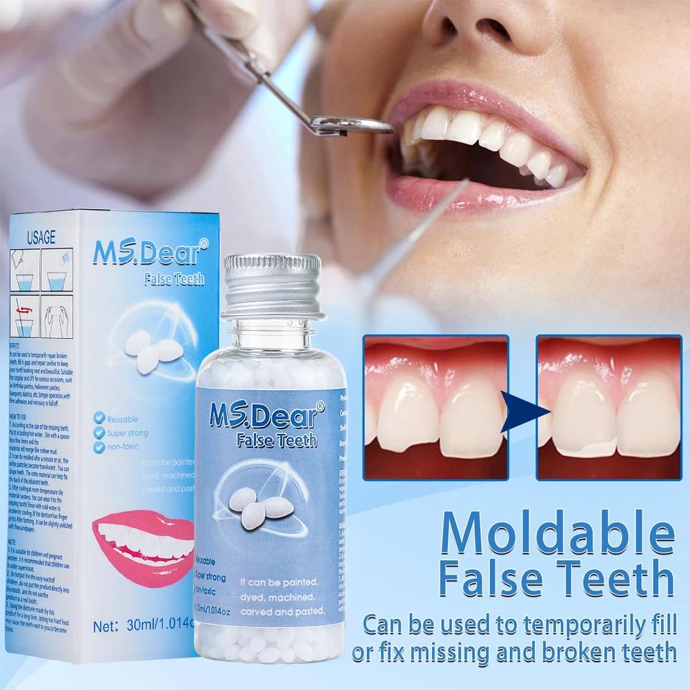 Granulés de réparation temporaire des dents en résine, 30ml, espace dentaire manquant, dents cassées