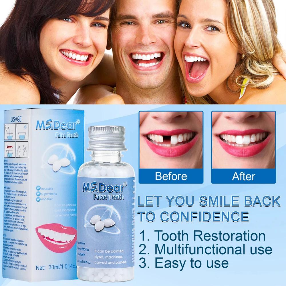 Granulés de réparation temporaire des dents en résine, 30ml, espace dentaire manquant, dents cassées