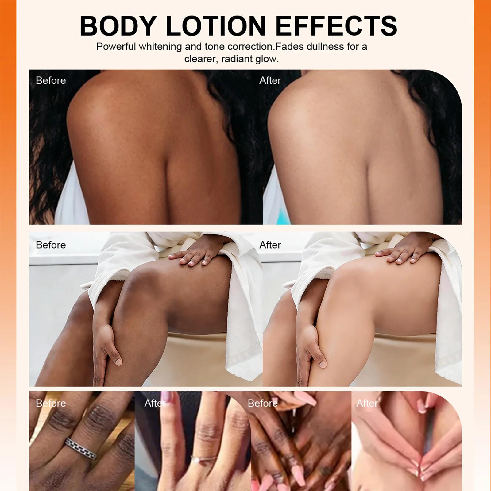 Lotion éclaircissante à l'arbutine LKIAE pour le visage et le corps, réduit les taches, nourrissante
