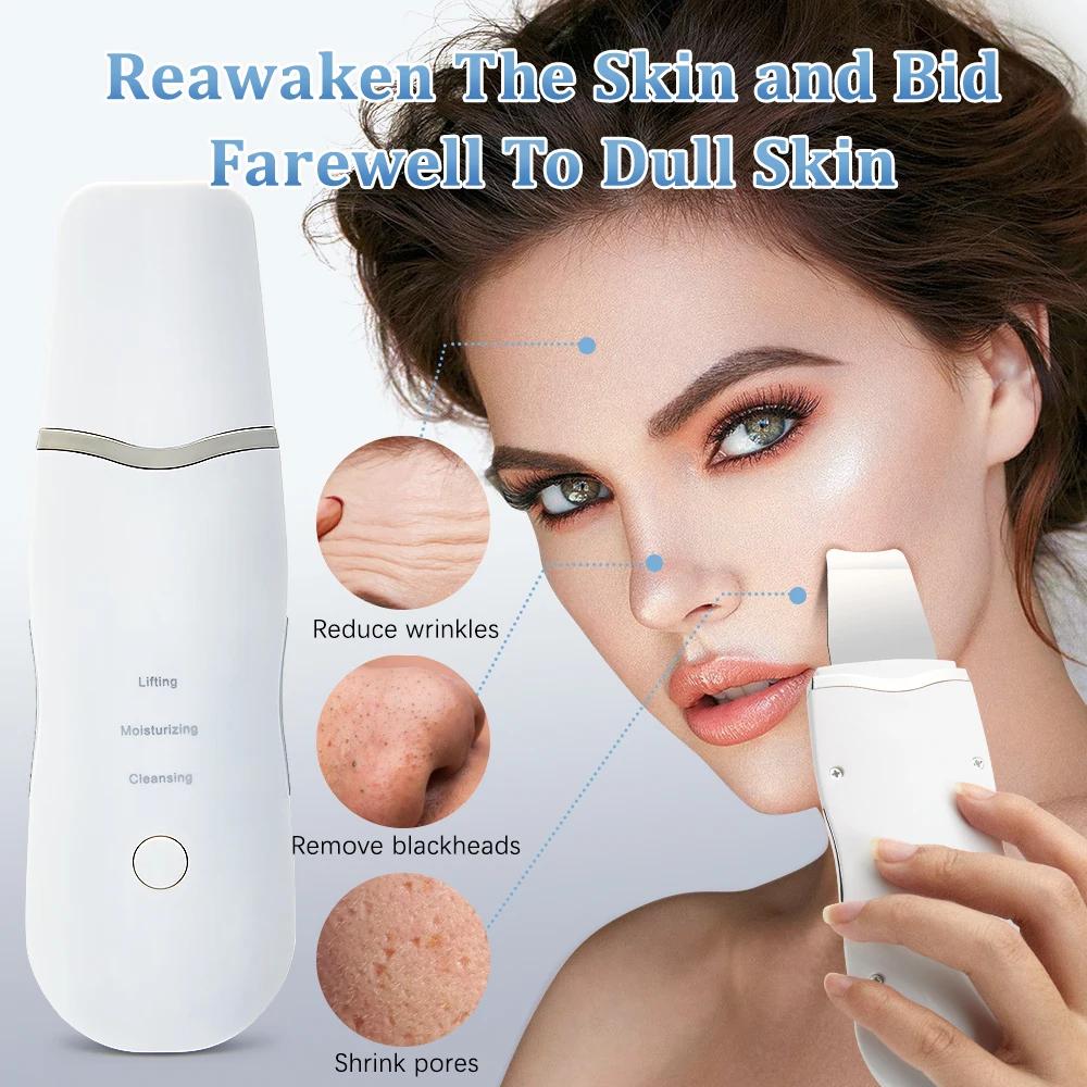 Épurateur de peau électrique à ultrasons, vibration du visage, spatule, épluchage, dissolvant de poi