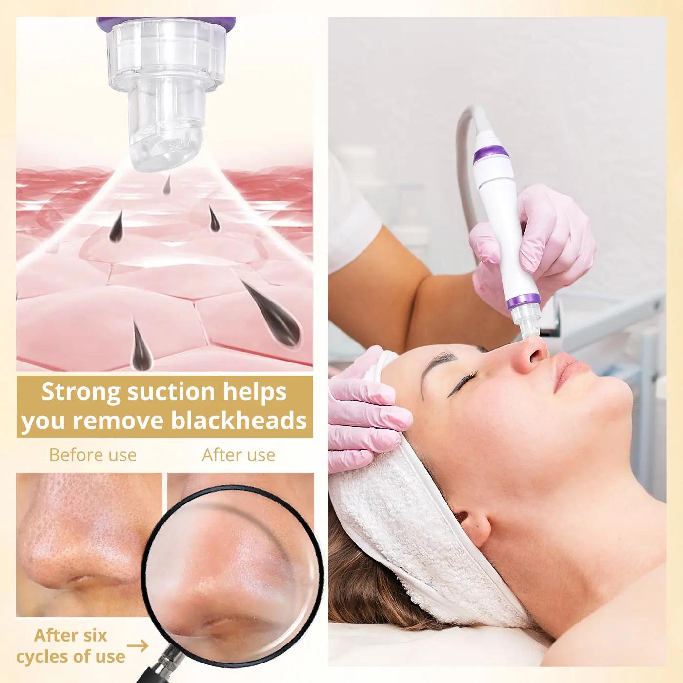 DermDelhi-Machine Hydro-Eau à Oxygène Professionnelle pour Soins de la Peau, Jet Peel Oxy Spray, Liv
