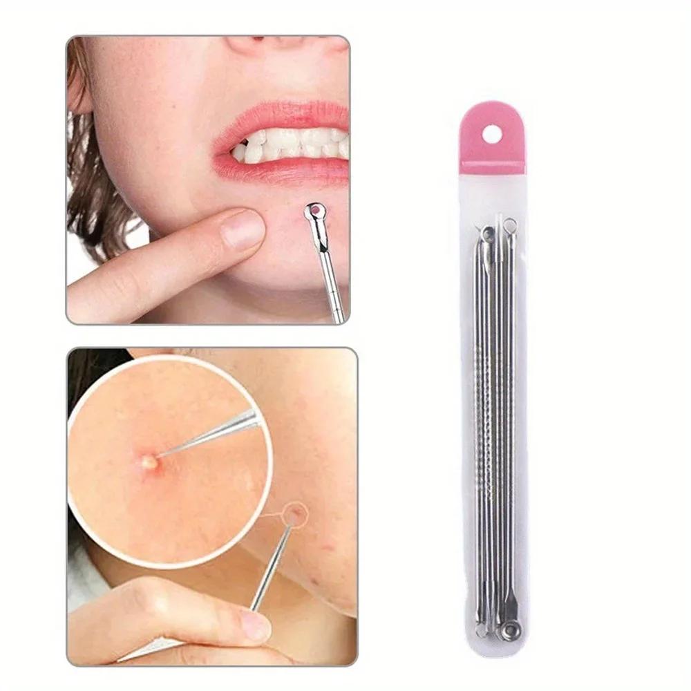 Kit d'extraction d'imperfections de boutons et d'acné, points noirs, aiguilles en acier inoxydable,