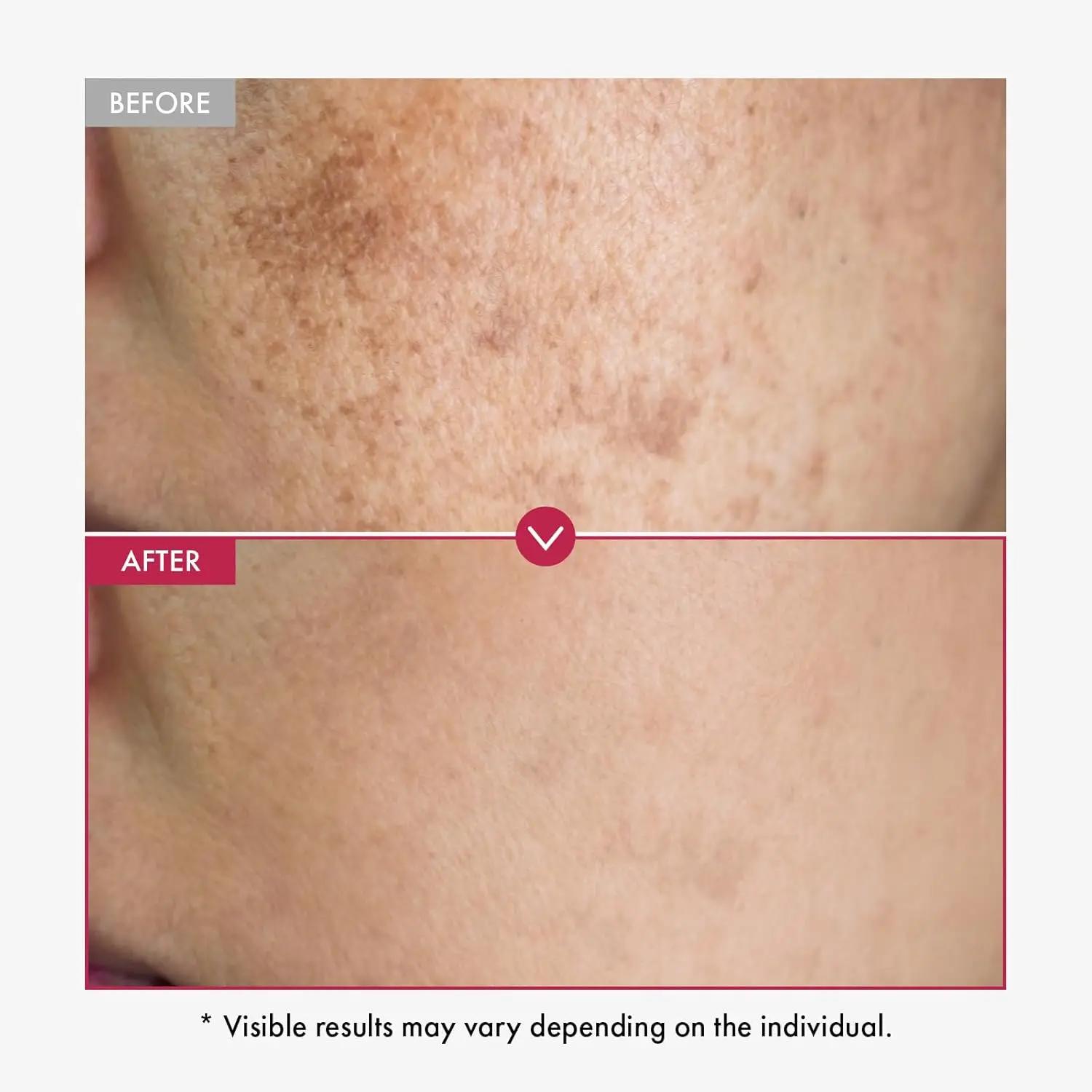 Sérum visage blanchissant pour la peau, 500ml, réduit les taches, hydratant, même le teint, avec Alp