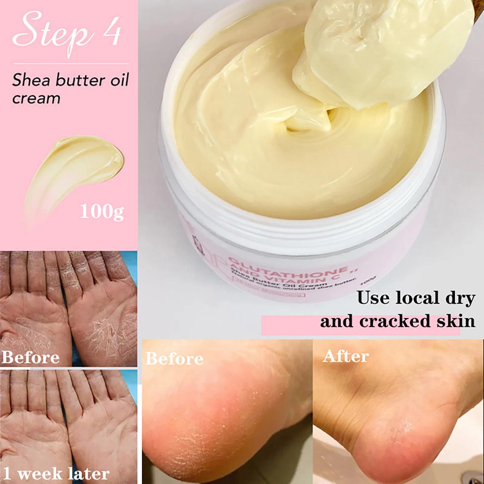 AILKE crème de soin blanchissante pour la peau, Lotion éclaircissante, élimine les taches foncées av