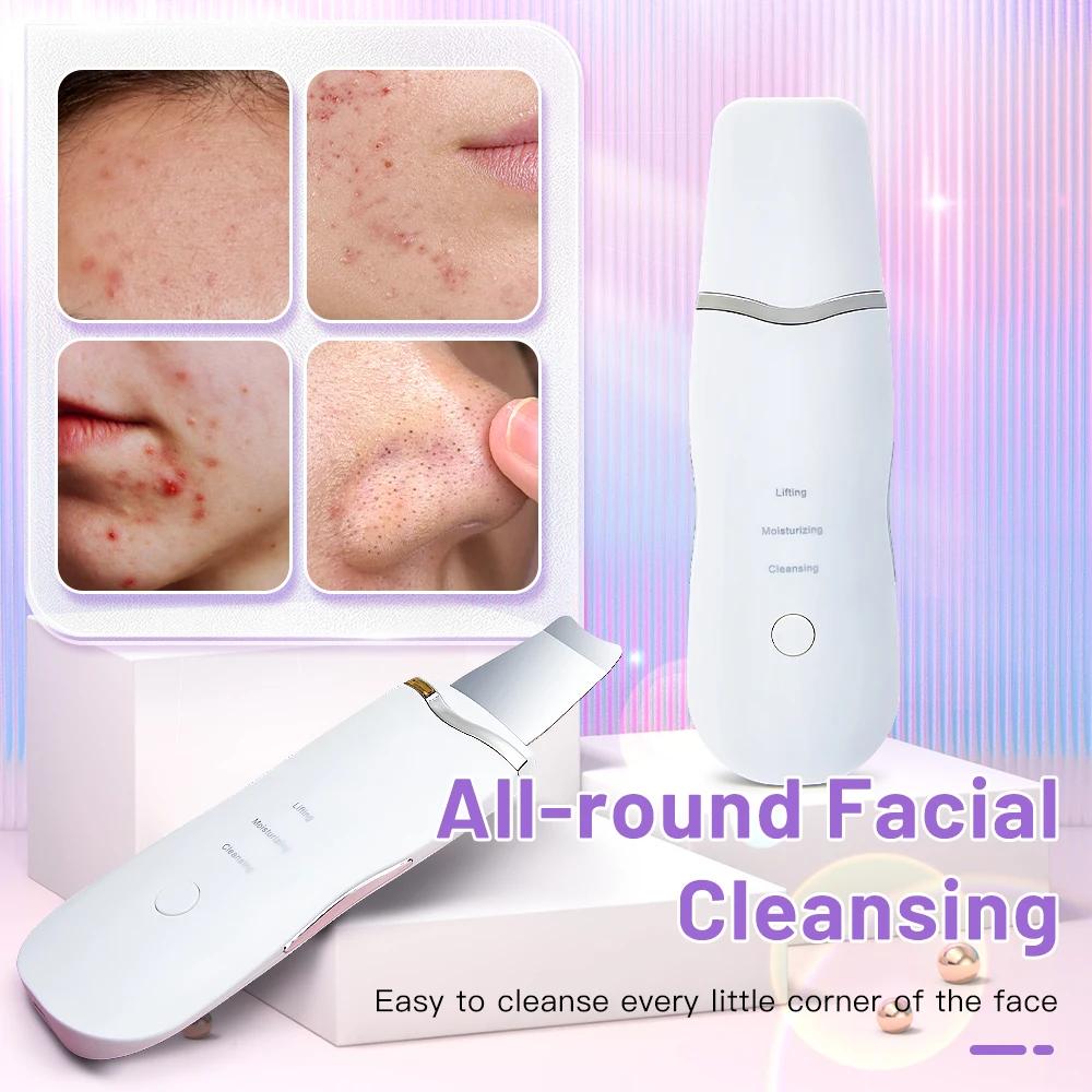Épurateur de peau électrique à ultrasons, vibration du visage, spatule, épluchage, dissolvant de poi