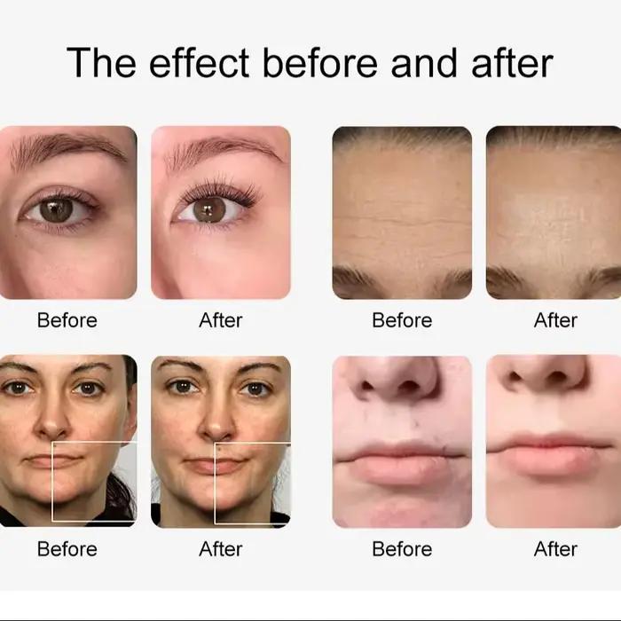 Hydro Machine à oxygène et eau 12 en 1, Lifting du visage, nettoyage en profondeur, Dermabrasion, Pe