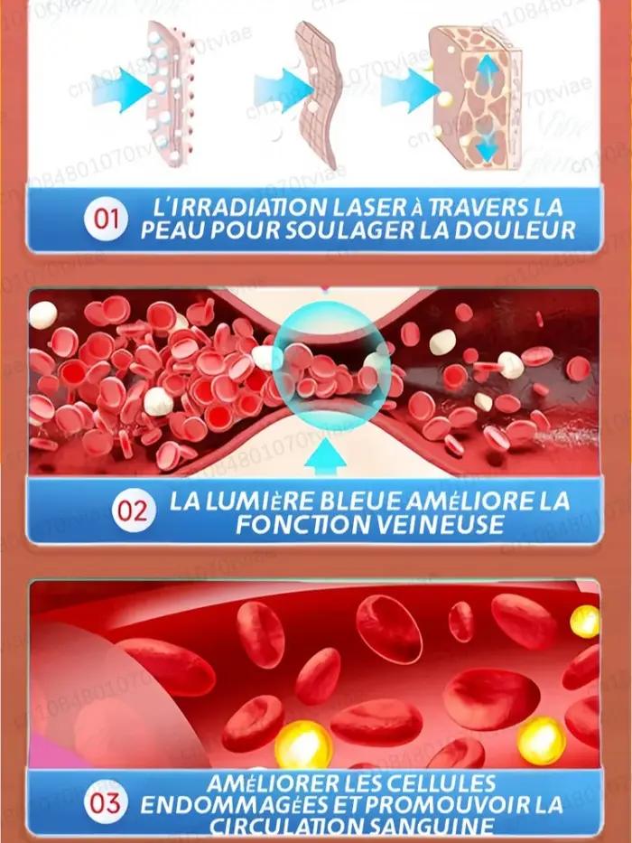 Promouvoir la circulation sanguine dans les varices