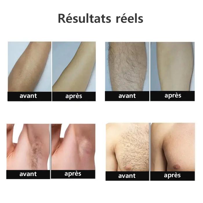 999999 Flashes épilateur Laser pour femmes hommes corps Bikini jambes bras aisselles épilation indolore IPL