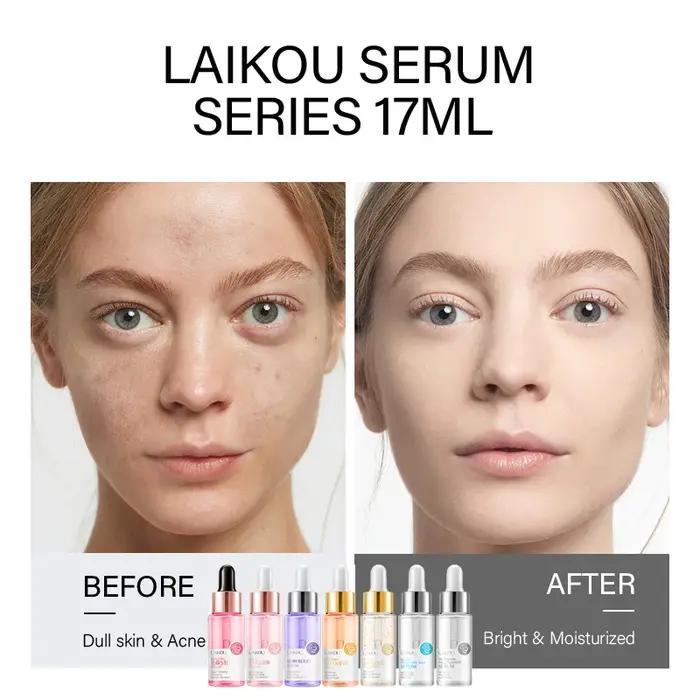 LAIKOU 7 bouteilles d'escargot d'or 24K Sakura acide hyluronique vitamine C Nicotinamida sérum de my