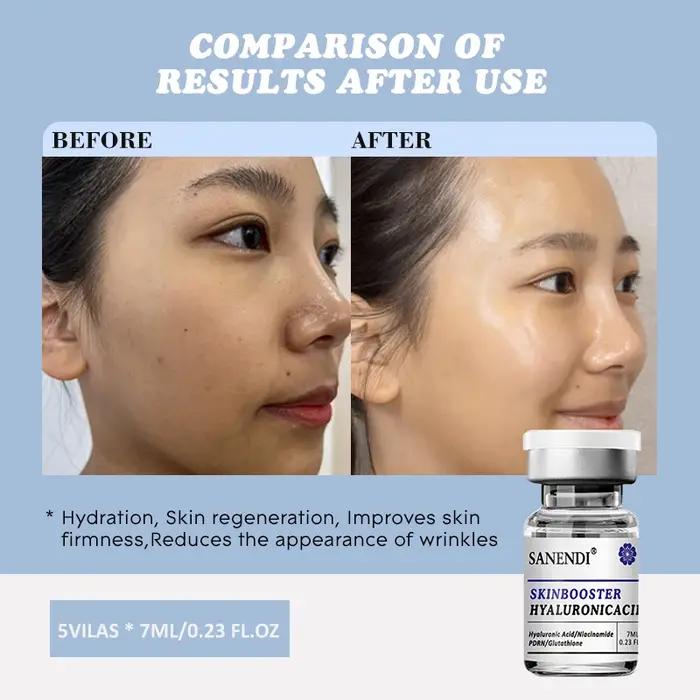Gel de soin pour la peau à l'acide hyaluronique PDRN, 7ML, avec Niacinamide, pour stylo Derma, verro